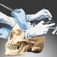 Image for article titled A tumor stole every memory I had. This is what happened when it all came back
